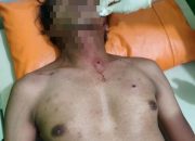 Gegara Ingkar Janji Seorang Pria Nekat Brondong Warga Dengan Airsoft Gun Di Prigen Pasuruan