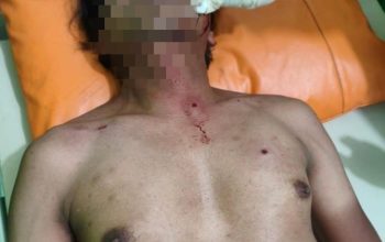 Gegara Ingkar Janji Seorang Pria Nekat Brondong Warga Dengan Airsoft Gun Di Prigen Pasuruan