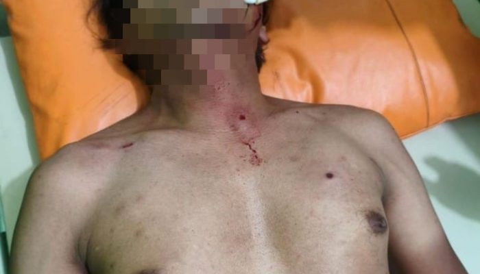 Gegara Ingkar Janji Seorang Pria Nekat Brondong Warga Dengan Airsoft Gun Di Prigen Pasuruan